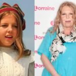 The Unseen Battle: Sally Thomsett’s Journey with Face Illness