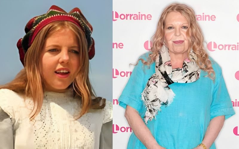 The Unseen Battle: Sally Thomsett’s Journey with Face Illness